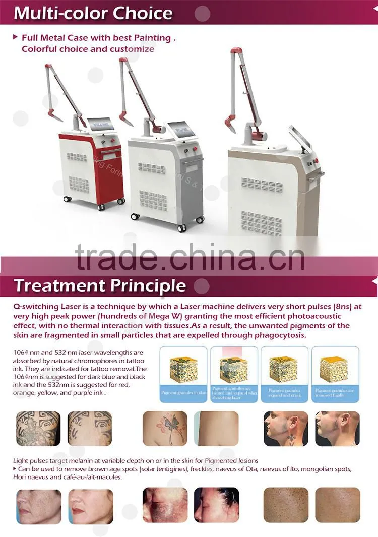 1064 nm / 532nm OEM / ODM varicose veins laser treatment laser tattoo removal equipment