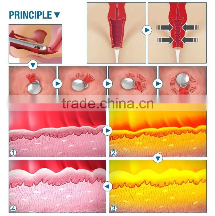 Professional vaginal tightening machine co2 fractional laser treatment for face and body