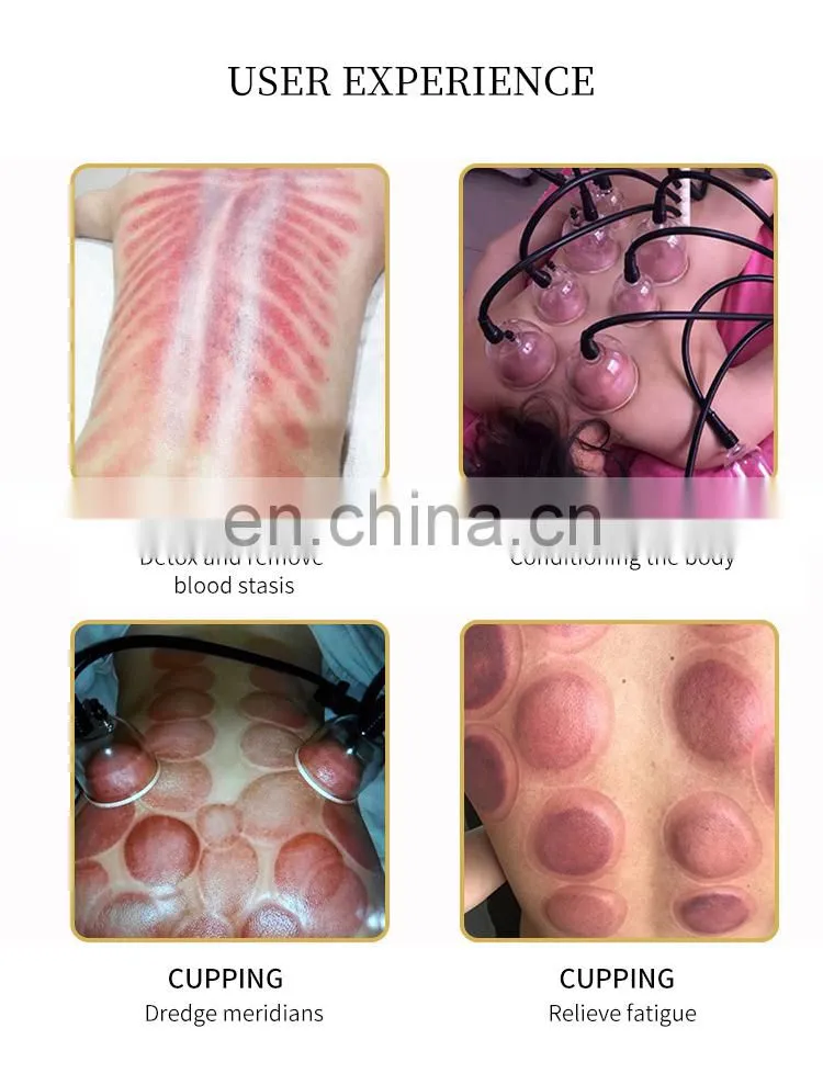 HOT Factory Vacuum Therapy Breast Enlargement Machine Vacuum Pump Butt Lift Breast Sucking Body Therapy Lymph Drainage