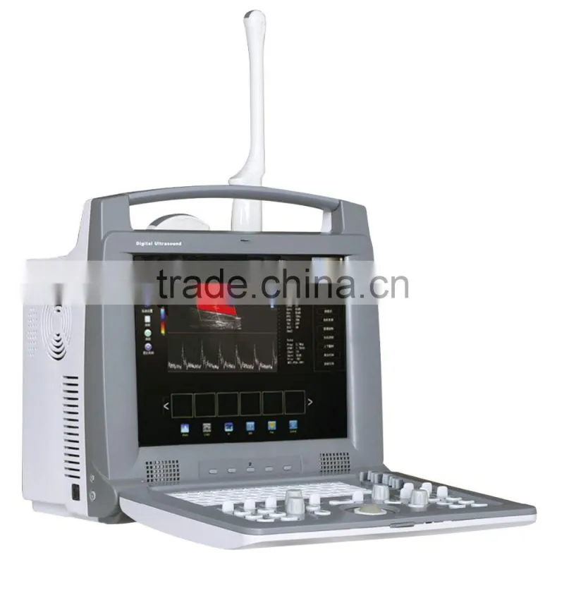 Laptop Color Doppler 2D Ultrasound Machine 12.1" high-resolution LCD