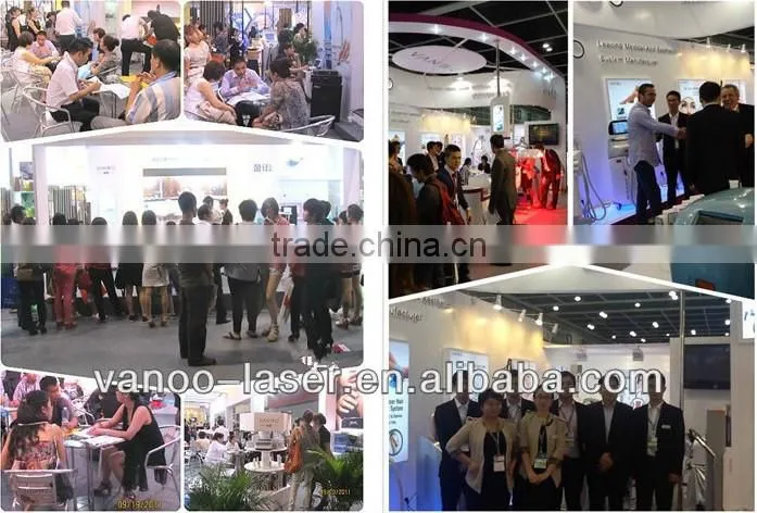 low cost professional laser hair removal machine for sale