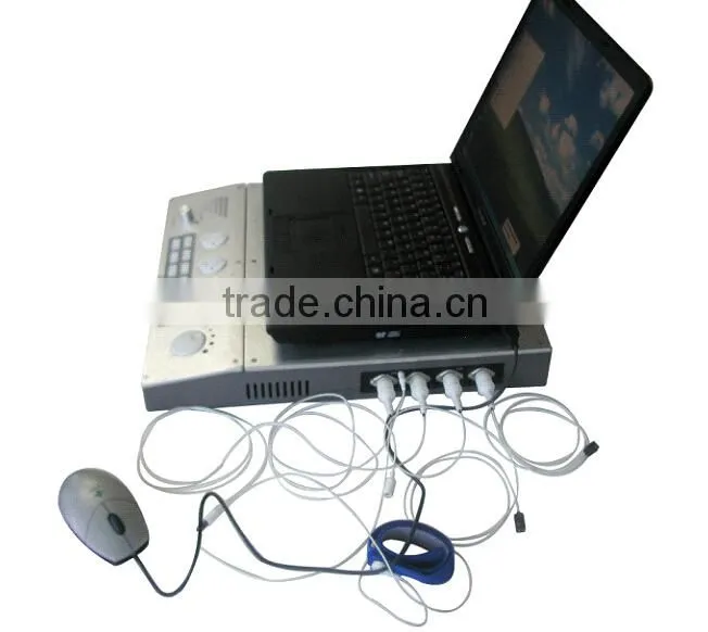 Professional EMG EP Systems Electromyography myoelectricity connecting computer for Neurology with CE ISO