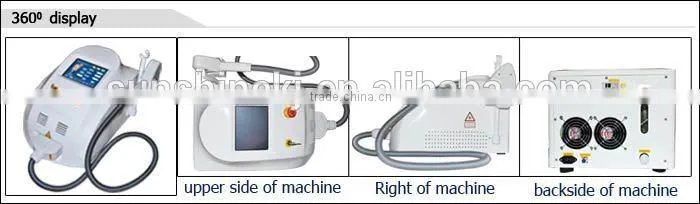 2015 New arrival Top sale lite sheer diode laser hair removal with CE/TUV