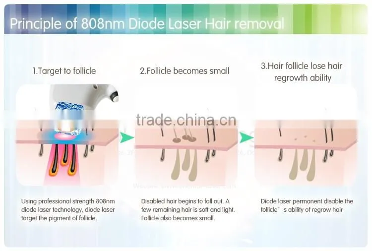 808nm diode laser hair removal machine no harm to skin/ no side-effect