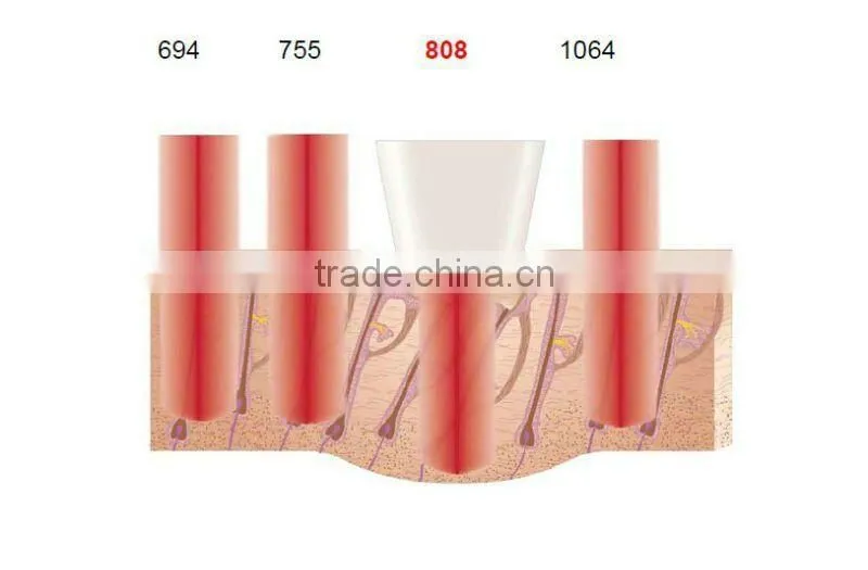Home laser hair removel, diode 808 laser, 808nm laser hair removal machine
