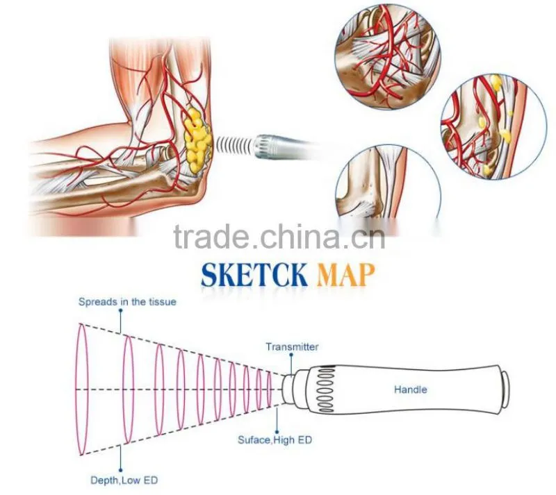 Hot selling shockwave therapy for body pain ultrasonic wave