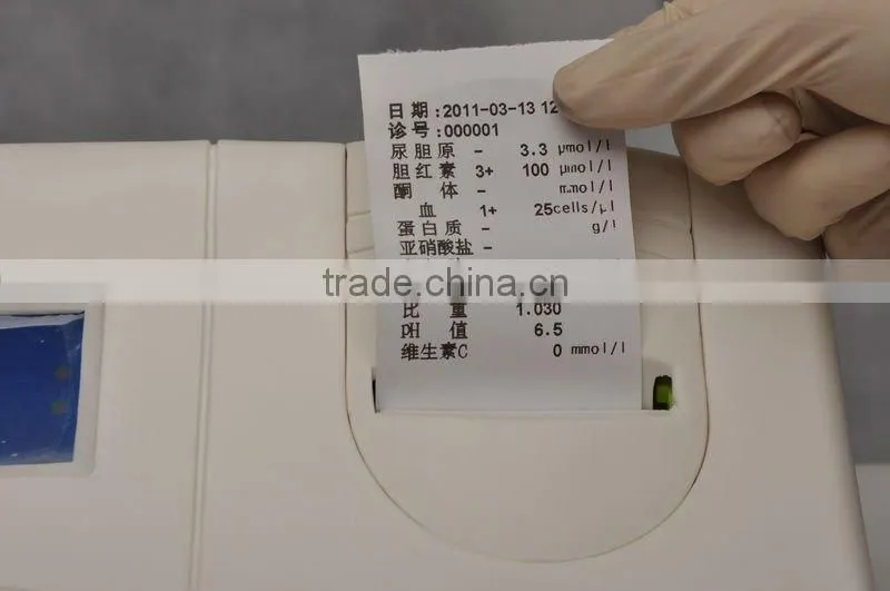Semi-automated Urine Analysis