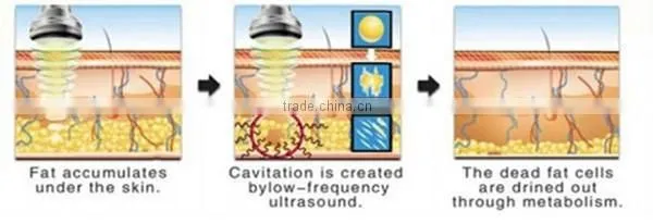 Factory direct sale! 5 in 1 multifunctional slimming device cavitation radio frequency slimming