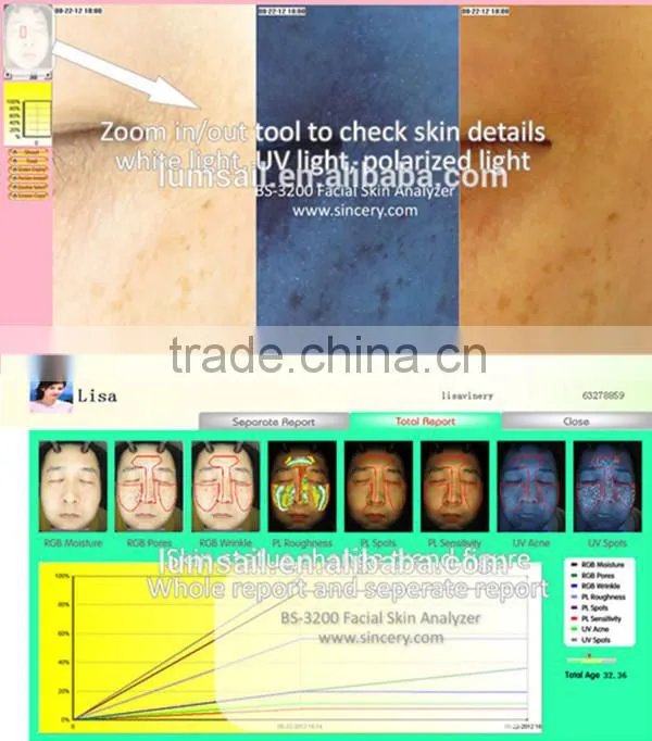 Magic Mirror Skin Analyzer