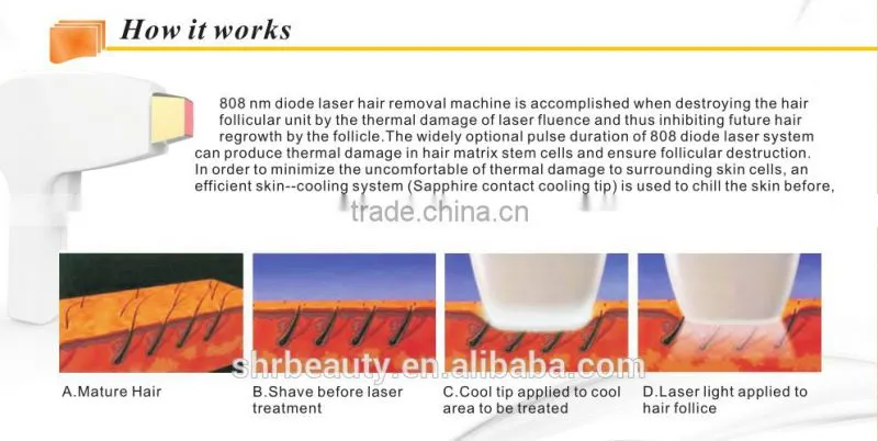 CE Approved Vertical Hair Removal 808nm Diode Laser