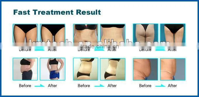 professional CE approved ultra lipo cavitation rf beauty slimming machine