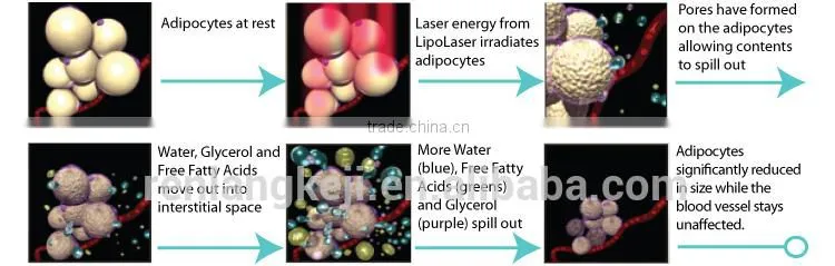Try it and you will like it! RL-I01! lipo cavitation and radio frequency machine