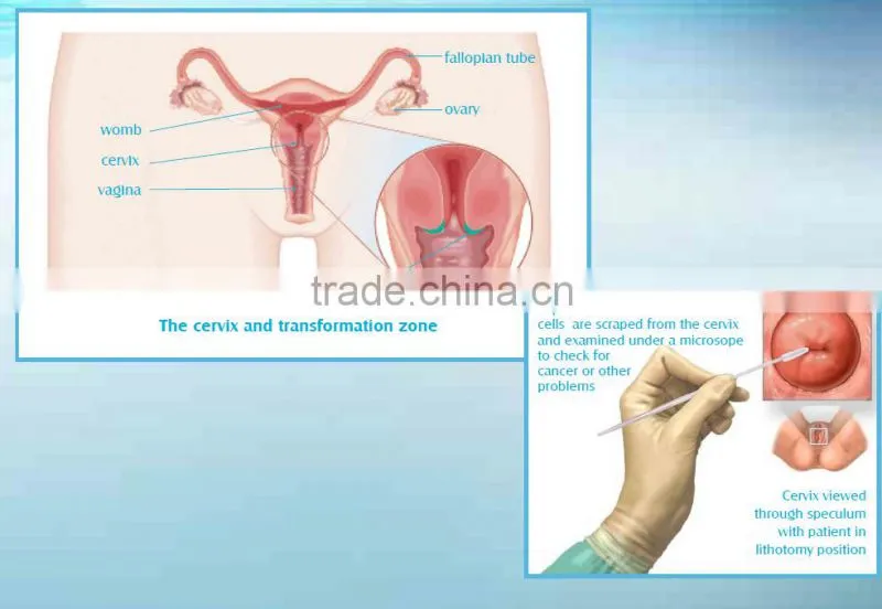Medical DNA collection swabs