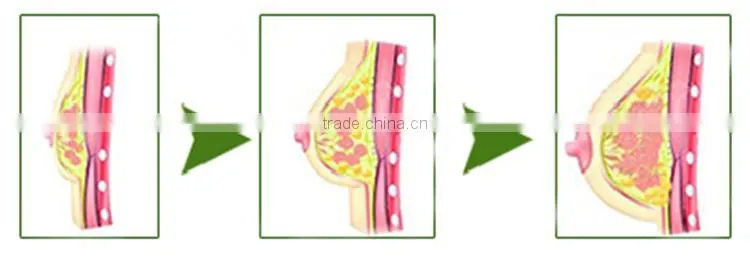Thailand Pueraria Mirifica breast enlargement capsule for Breast Growth