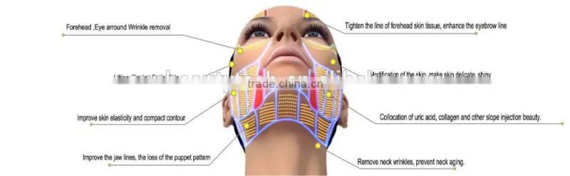 Portable smart 3D anti wrinkle treatment HIFU beauty machine