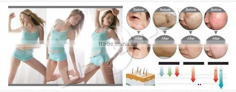 OSANO HIFU Slimming Machine ( LM-S809A)