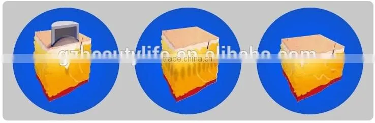 Lipo HIFU /LipoHIFU ultrasound Slimming System HIFU-10