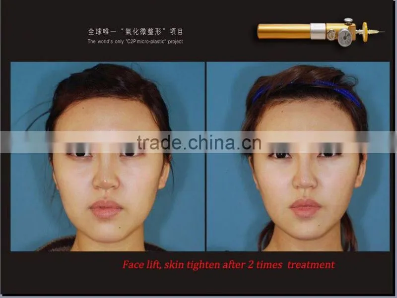 2016 Most popular CDT skin care equipment !!