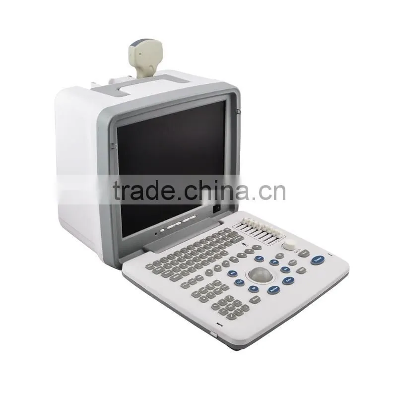 2016 Large Screen LED Good Image Full Digital Portable Ultrasound Scanner Machine with Probe-External Workstation (80 element)