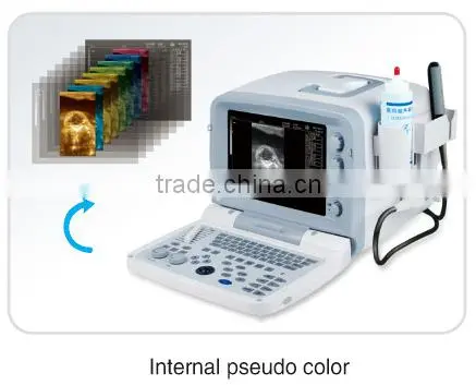 FN200V Full digital B model veterinary portable ultrasound scanner