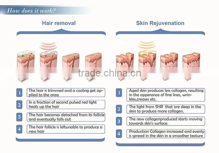 two handles shr ipl diode laser hair removal machine price