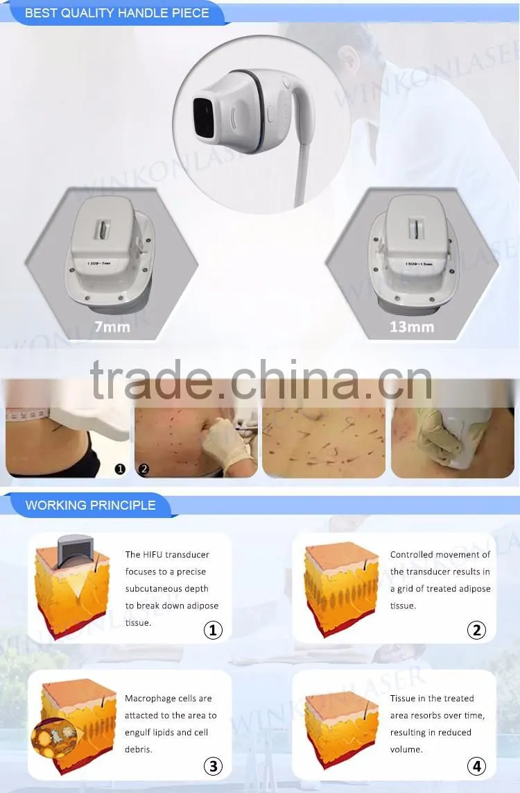 High intensity 2 years warranty focused ultrasound hifu liposonix device for weight loss