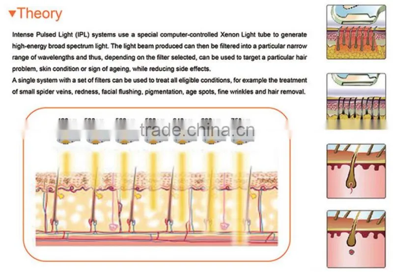 Spa & Salon & Clinic ipl hair removal/ IPL machine price