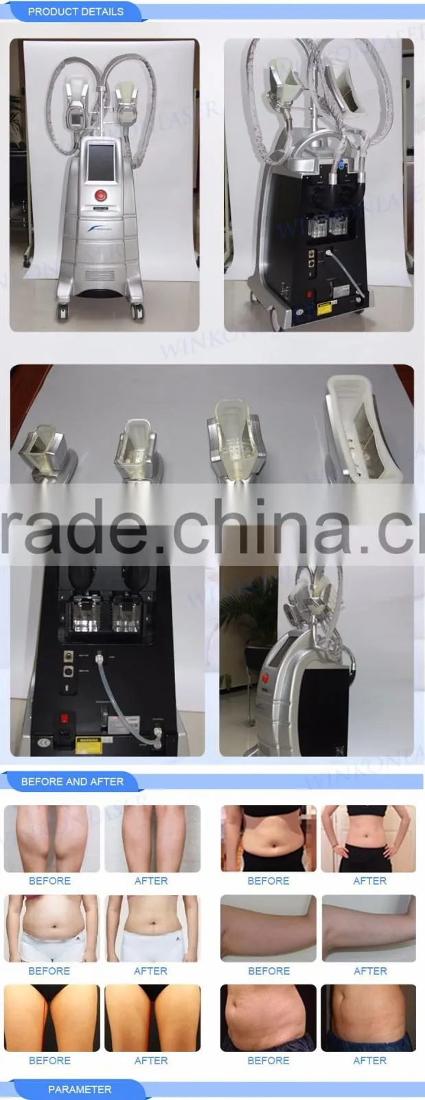 Low price CE / Rohs approved weight loss cold body sculpting cryolipolysis machine