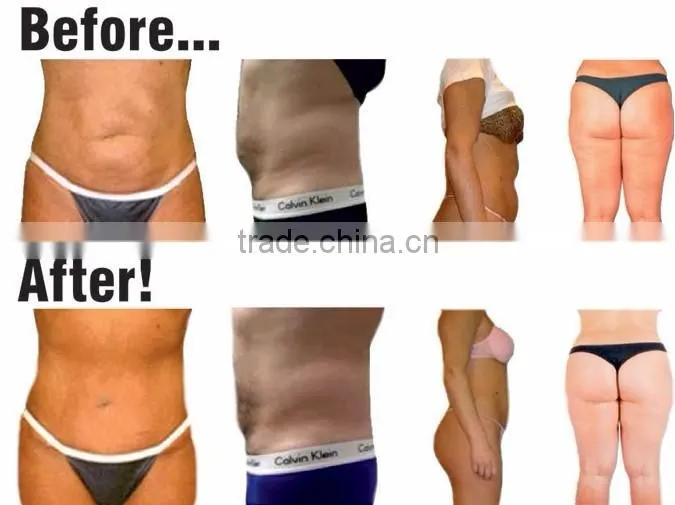 Super Slimming Fat Dissolving lipolaser/diode laser/slimming machine