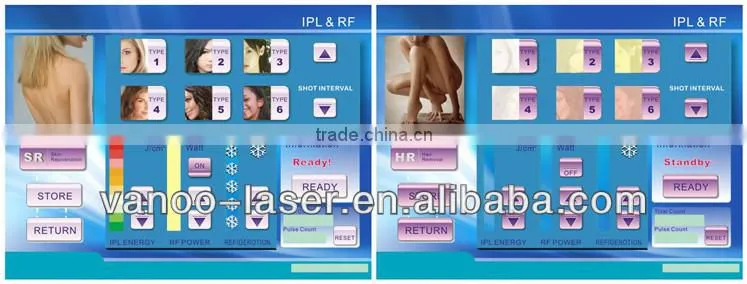 Ipl rf laser flash lamp ipl xenon lamp
