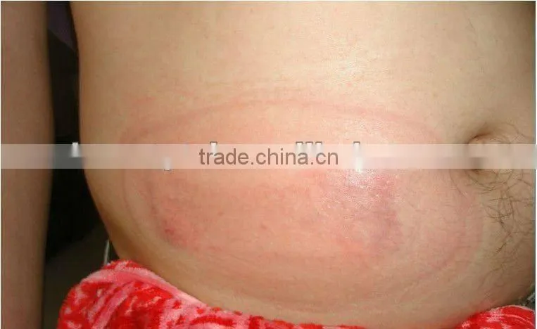 Hot Sale! cold sculpting machine, slimming machine, cryolipolysis