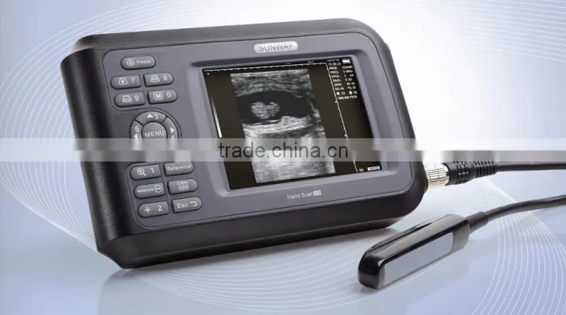 V8 Handle type Digital veterinary ultrasound scanner