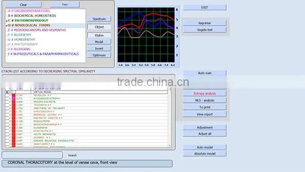 Quantum Health Analyzer Auto Full Body Health Analyzer 9D Full Body Analyzer