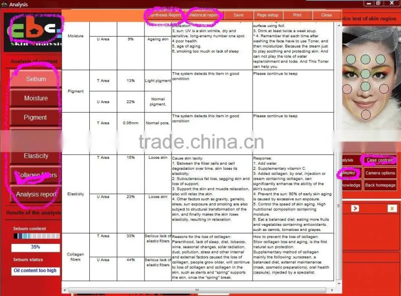 professional facial skin analysis / 3d skin analyzer