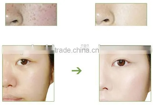 Tahiti Black Pearl Skin Care Face Cream Capsule