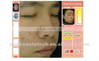 Mirror System/Skin Analyser Machine