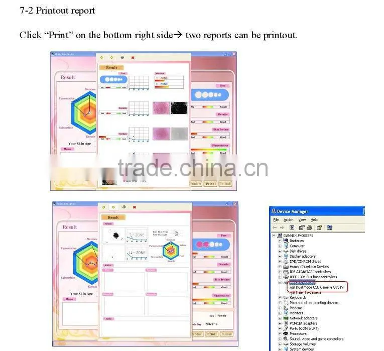 Wholesale skin analyzer machine