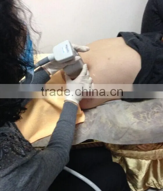 Non-surgical fat reduction lipohifu 576 point hifu slimming machine for body shape