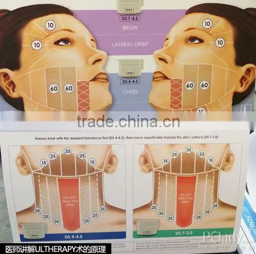 Hottest!!! Anti-wrinkle High Intensity Focused Ultrasound Knife