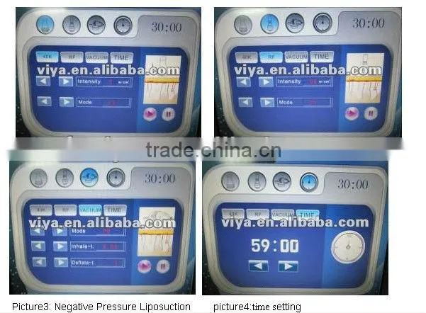 VY-X5 Hotsale ultrasound physiotherapy equipment for sale