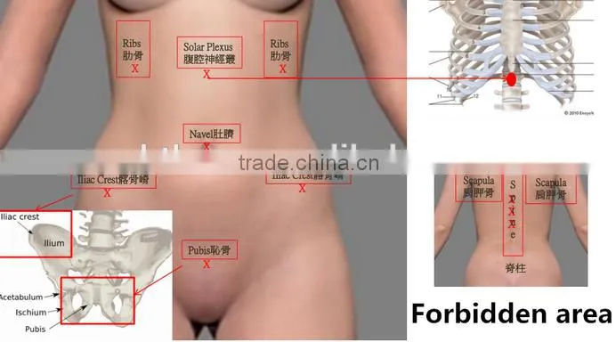 factory price multifunction liposonix hifu slimming machine