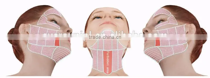 2015 Hot!! hifu / hifu machine / hifu face lift