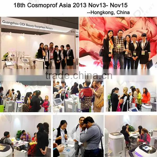 Top selling products in Alibaba ! Permanently diode laser hair removal machine (OD-LS808)