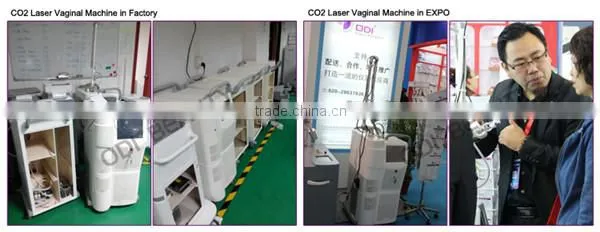 10600nm stretch mark scar removal laser co2 fractional with vagainal tightening co2 laser head