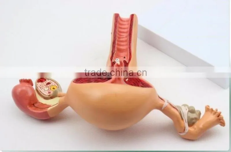 Human uterus and ovary vaginal pathological changes model of reproductive Department of gynecology medical demonstration model