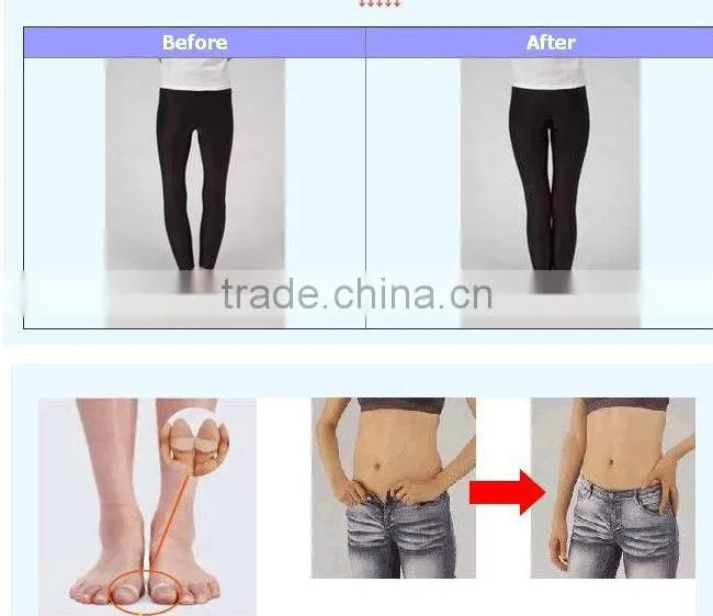 fashion silicone foot toe ring lose weight products
