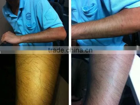 Best Hair removal machine S3000 CE/ISO ipl shr hair removal machine IPL OPT SHR