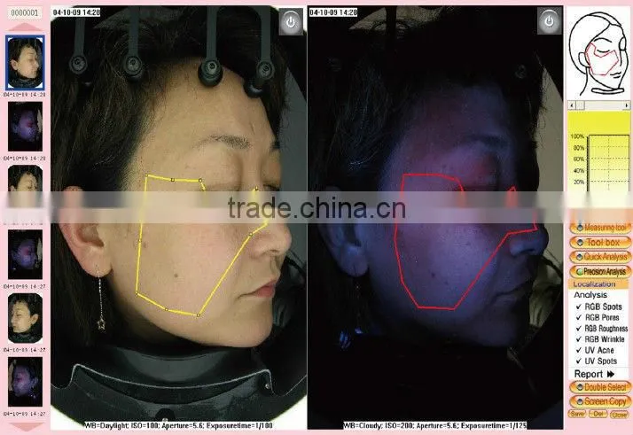 whole face testing skin analyzer magic mirror