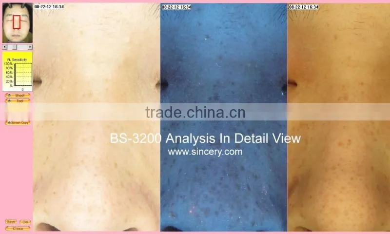 2015 Newest professional skin analylzer face map