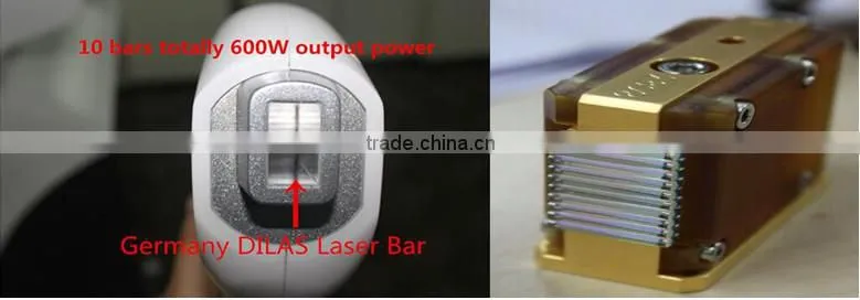 New products best hair removal machine 808nm diode laser hair reduction wanted 2016